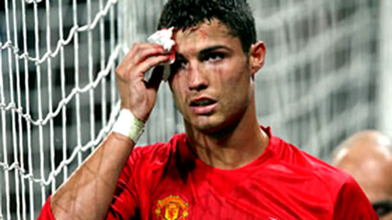 Patru puncte de sutură pentru Cristiano Ronaldo, după meciul cu AS Roma