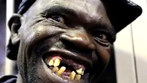 Cel mai urât bărbat din Zimbabwe: Câştigătorul, contestat pe motiv că 