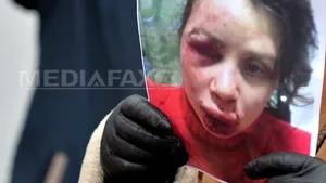 Ambasadori ai unor ţări occidentale au vizitat-o la spital pe jurnalista agresată la Kiev