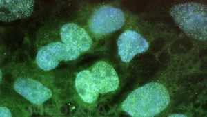 Celulele stem pot încetini evoluţia bolilor Alzheimer şi Parkinson