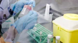 Încă 11 persoane cu variola maimuţei în Anglia, numărul total se ridică la 190