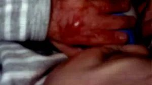 Părinţii bebeluşului ars la Maternitatea Bucur depun la instanţă fotografii şocante de după incident
