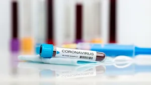 Statele Unite aprobă urgent un test pentru depistarea rapidă a coronavirusului. „Accelerăm viteza de zece ori