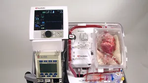 Un deputat USR propune modificări legislative pentru activitatea de transplant din România