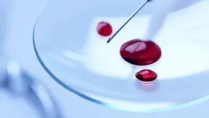 VINDECARE PENTRU SIDA? Doctorii au anunţat primul caz de vindecare funcţională a unui nou-născut infectat cu HIV - VIDEO