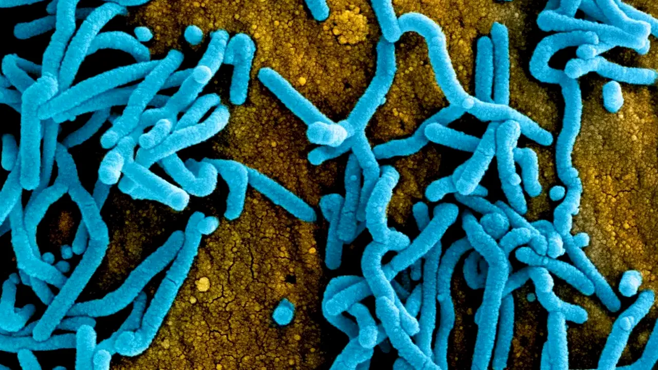 Ameninţarea virusului Marburg, asemănător cu Ebola. Rwanda în faţa unei crize sanitare?