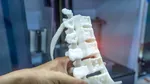 Proiect unic în Europa: două celebre spitale din Barcelona vor dezvolta soluții pentru sănătate cu imprimare 3D