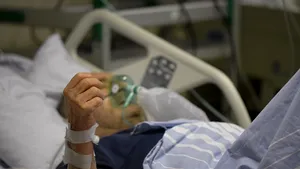 Plămânii pacienţilor vindecaţi de COVID-19 arată mult mai rău decât cei ai fumătorilor. Iată radiografiile