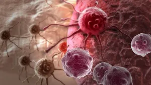 Descoperire VITALĂ privind dezvoltarea cancerului: 