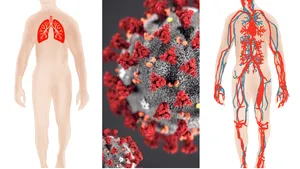 MULTIMEDIA Mediafax.ro: COVID-19, prădătorul întregului organism. Cum deturnează coronavirusul corpul uman