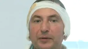 INCENDIUL din Colectiv: Consilierii din Mangalia au aprobat un ajutor de urgenţă pentru una dintre victime