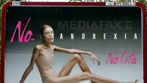 Modelul francez Isabelle Caro, care suferea de anorexie de 15 ani, a murit