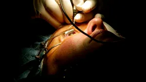Suplimentele de vitamina C cresc riscul de cataractă