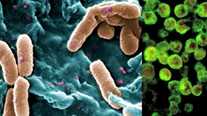 Epidemie de holeră în Nigeria: 58 de morți și peste 250 de persoane infectate
