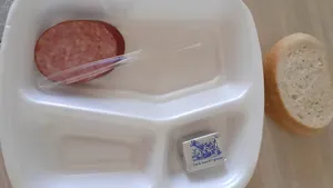 Schimbare în meniul pacienţilor. Ministerul Sănătăţii vrea să elimine plafonul maxim al alocaţiilor de hrană din spitale