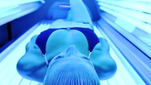 O femeie a ajuns la spital cu arsuri de gradul doi după ce a vrut să se bronzeze la solar. Victima va da în judecată patronii salonului