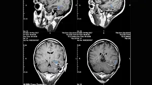 Cercetătorii au găsit o soluţie simplă pentru o memorie mai bună. Experimentul care a dus la descoperirea surprinzătoare