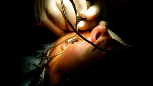 Corneea biosintetică, o soluţie eficientă pentru restaurarea vederii