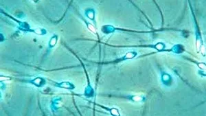 Ultrasunetele ar putea fi folosite în contracepţia masculină