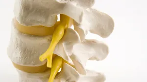 Discurile vertebrale sintetice, posibilă soluţie contra durerilor de spate