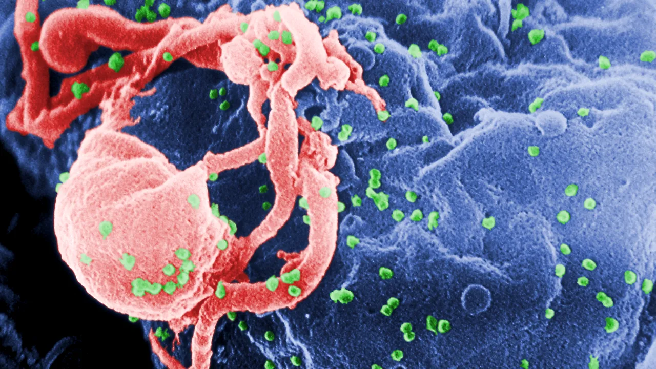 Pas important în lupta împotriva HIV. O nouă tehnologie folosită elimină părţile ,,rele
