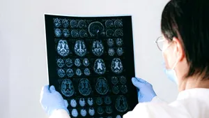 Descoperire promițătoare pentru tratamentul epilepsiei