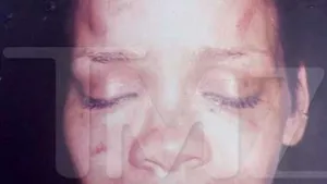 Rihanna desfigurată (Video)