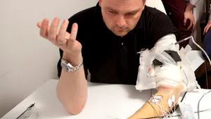 Eleve premiate pentru un proiect de reabilitare medicală a mâinii