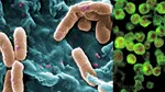 Bacteriile rezistente la antibiotice ar putea ucide 40 de milioane de oameni până în 2050