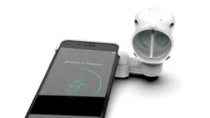 Sanofi lucrează la un test Covid-19 pe smartphone. Rezultatul ar fi dat în doar 30 de minute. Cum arată dispozitivul conectat la telefon 