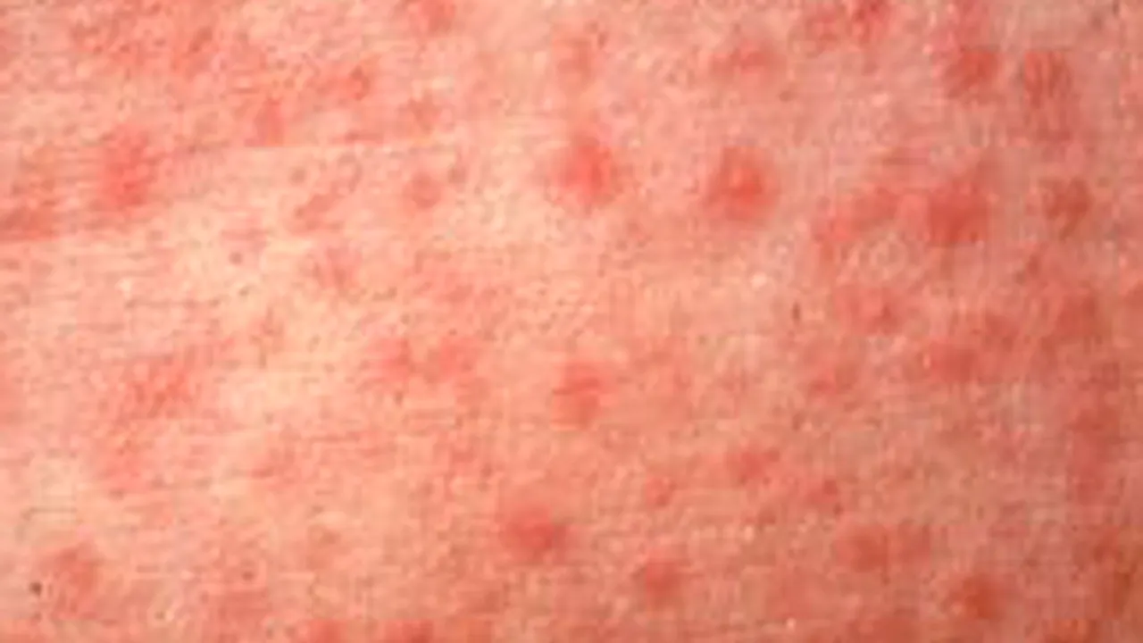 Epidemie de pojar în Statele Unite