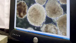 Un vaccin pe bază de celule suşă, împotriva cancerului la colon