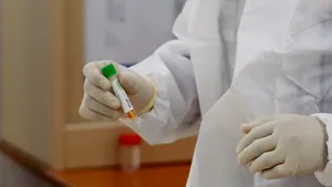 Studiu: Coronavirusul din spatele Covid-19 poate produce de trei ori mai mulţi agenţi patogeni decât cel din spatele virusului Sars