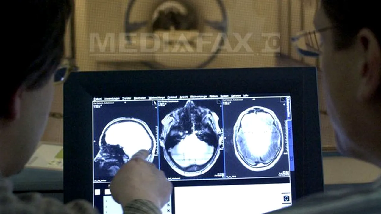 Premieră la Spitalul Bagdasar: Implantantare de electrozi în creier pentru studiul şi tratamentul epilepsiei