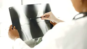 Descoperire medicală majoră: O injecție anti-îmbătrânire regenerează cartilajul genunchiului