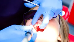 Regulile simple care îţi ajută copilul să nu aibă nevoie de dentist în această perioadă. Ce trebuie făcut odată cu apariţia dinţilor de lapte 