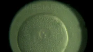 În România se fac anual de 10 ori mai puţine fertilizări in vitro decât în Europa de Vest