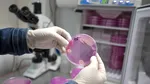 Experții trag un semnal de alarmă: o ciupercă patogenă ar putea ucide milioane de oameni