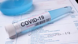 Italia dezvoltă un tratament pentru Covid-19, folosindu-se de sângele pacienţilor infectaţi