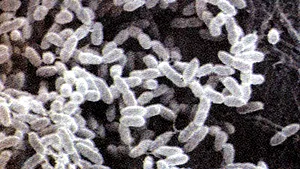 Cancerul la colon, cauzat de o bacterie care provoacă diareea