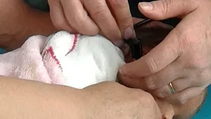 Screening auditiv pentru nou-nascutii din maternitatile din Cluj-Napoca si Baia Mare