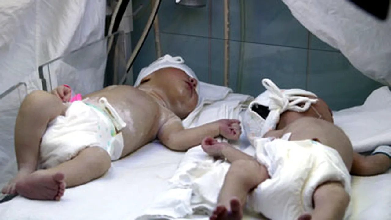 Peste 33% din decesele bebeluşilor în prima lună de viaţă, cauzate de boli cardiace nedepistate
