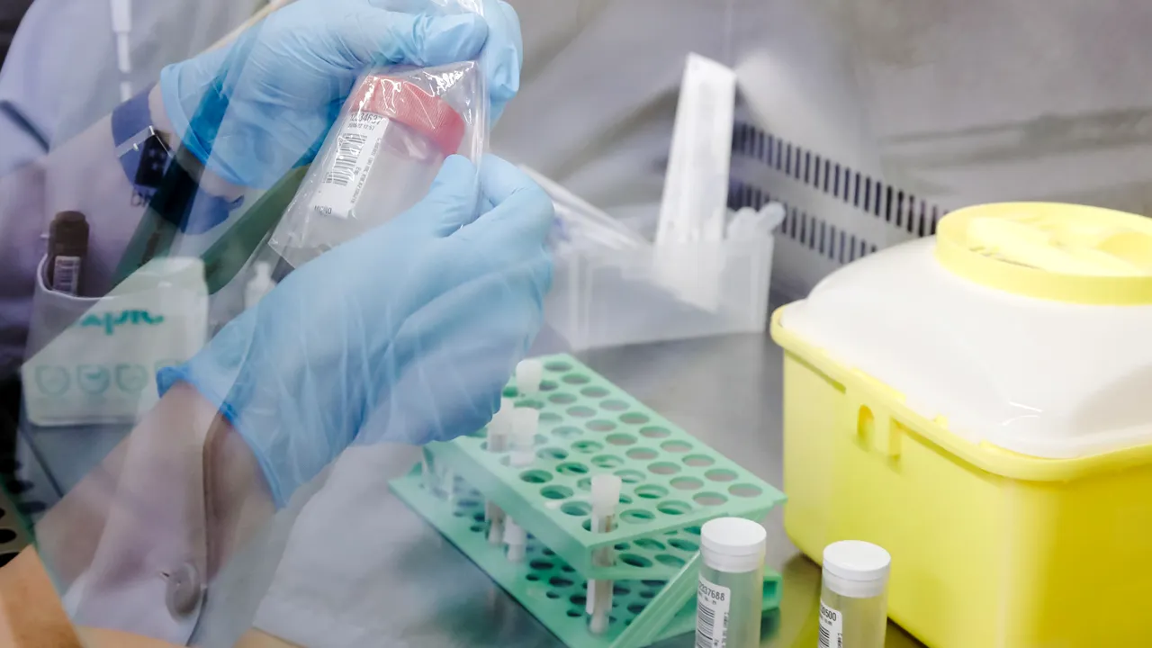 SUA comandă alte 2,5 milioane de doze de vaccin împotriva variolei maimuţei