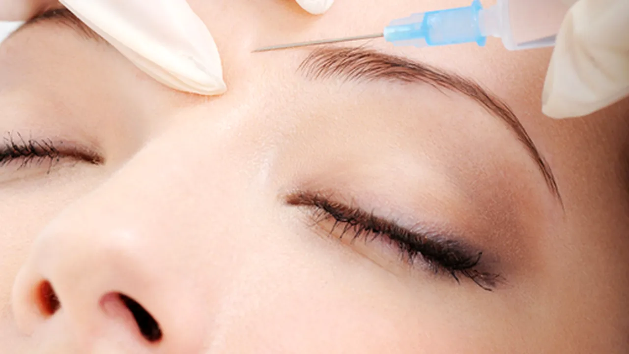 Tratament cu acid hialuronic pentru umplerea ridurilor faciale. Efect instantaneu după prima injectare