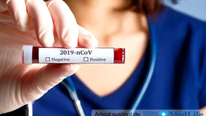 Ce tip de test este recomandat pentru a afla dacă avem anticorpi specifici SARS-CoV-2. Explicaţiile unui medic specialist