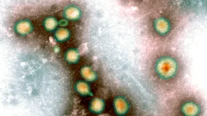 Al cincilea caz de mpox cu tulpina Clade 1b confirmat în Marea Britanie