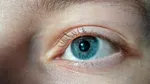 Ochii care nu sunt perfect rotunzi, predispuși la astigmatism