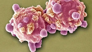 SFATURILE experţilor pentru a preveni apariţia cancerului