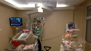 Medic: Siamezele Maria şi Elena au luat în greutate, ar putea fi externate în două-trei zile - FOTO