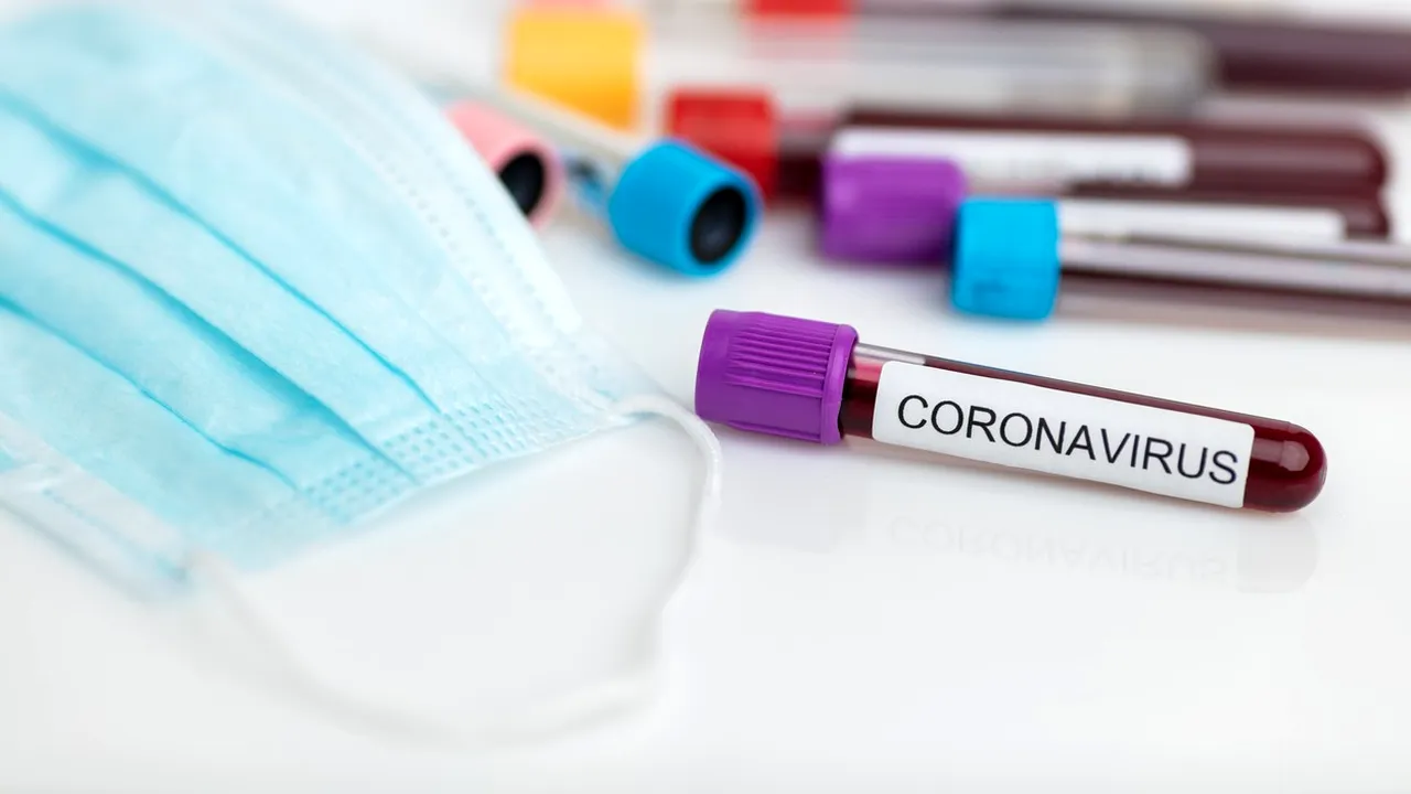 Orban anunţă achiziţionarea a 20 de aparate de testare pentru coronavirus